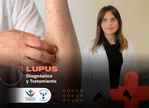 Lupus: una enfermedad autoinmune que el Madariaga aborda de manera integral